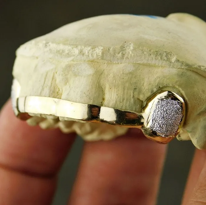 Rings Real 10K Solid Gold Diamond Dust TwoTone Canines Front Bar Custom Grillz Bling Cartel Admin