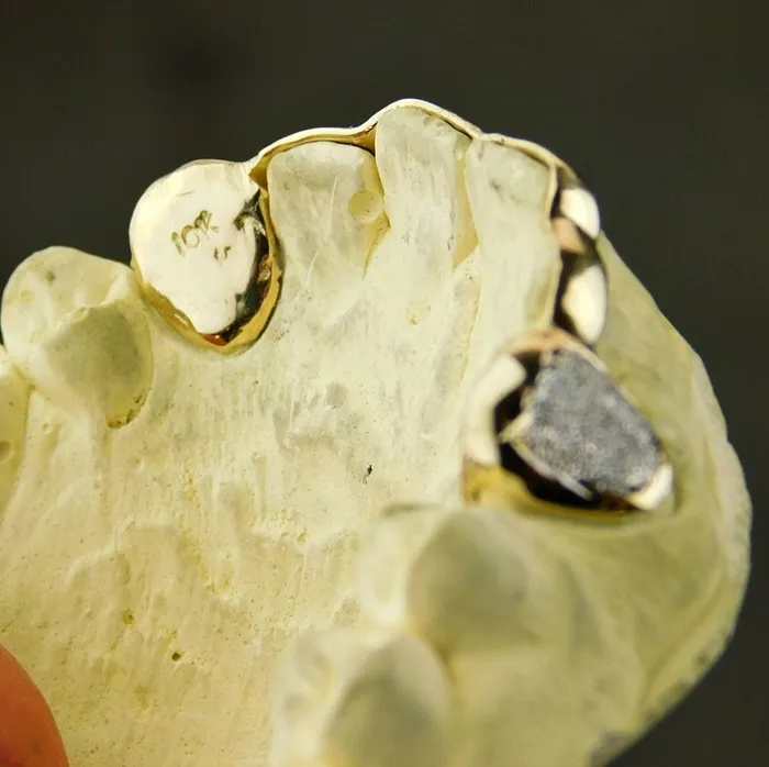 Rings Real 10K Solid Gold Diamond Dust TwoTone Canines Front Bar Custom Grillz Bling Cartel Admin